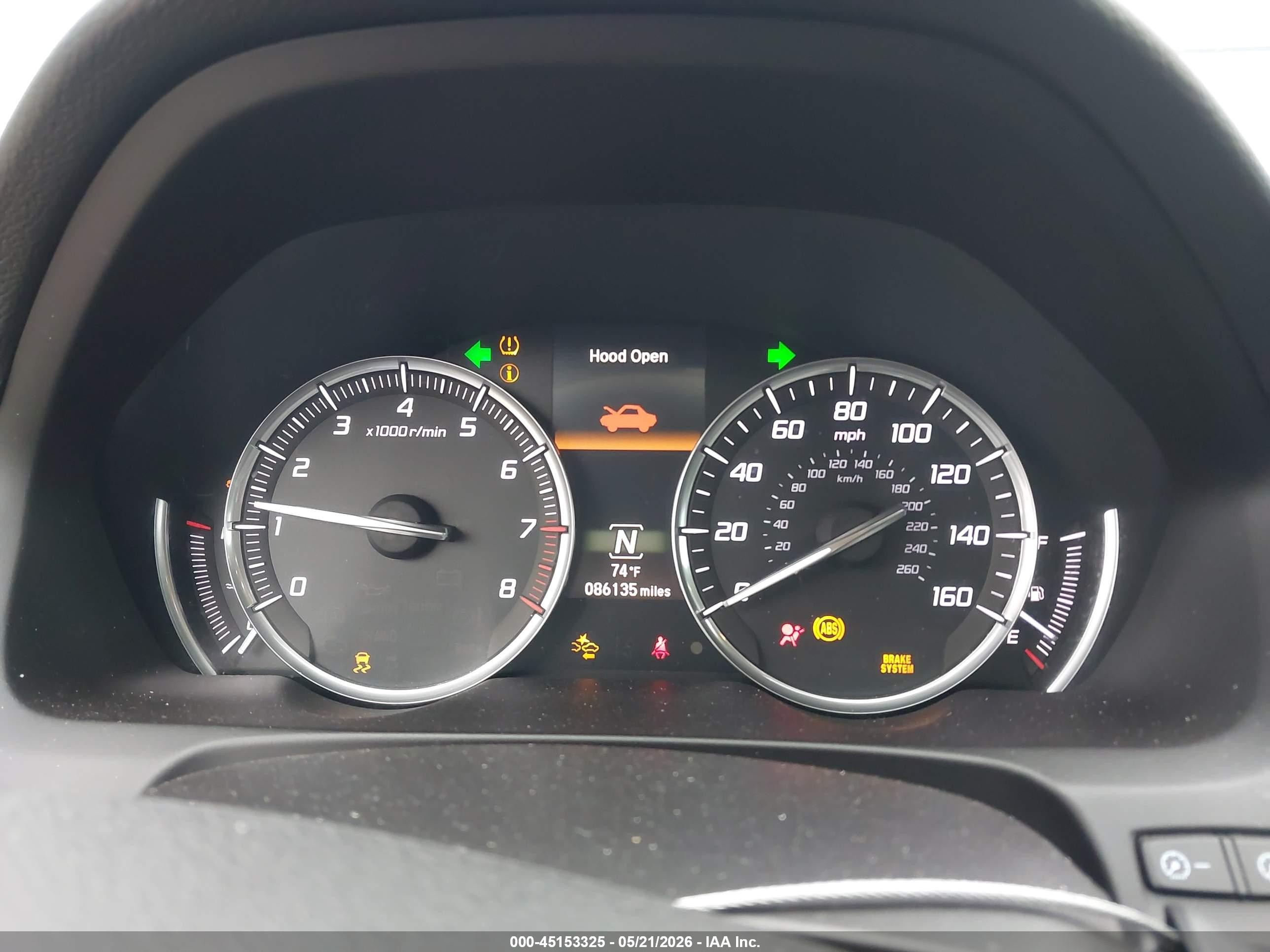2015 Acura Tlx Tech Gray vin: 19UUB1F51FA028737