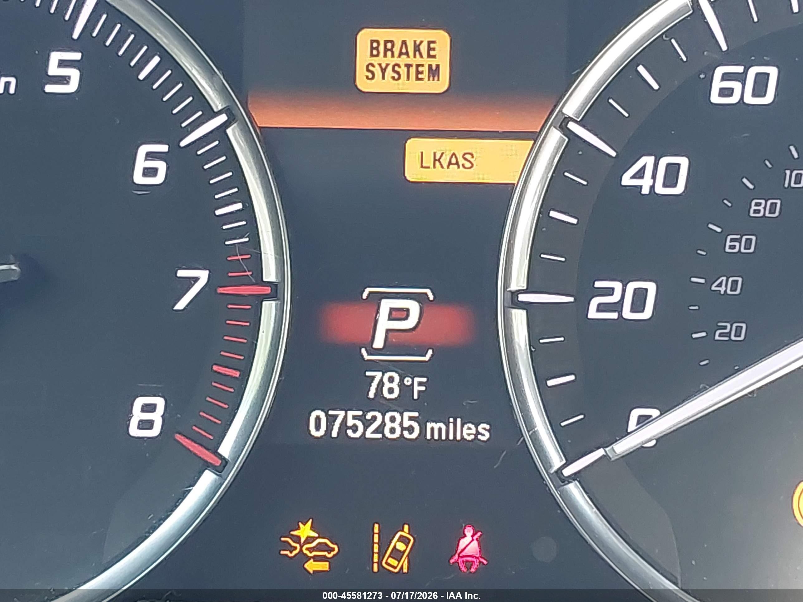 2015 Acura Tlx V6 Tech Gray vin: 19UUB3F52FA008167
