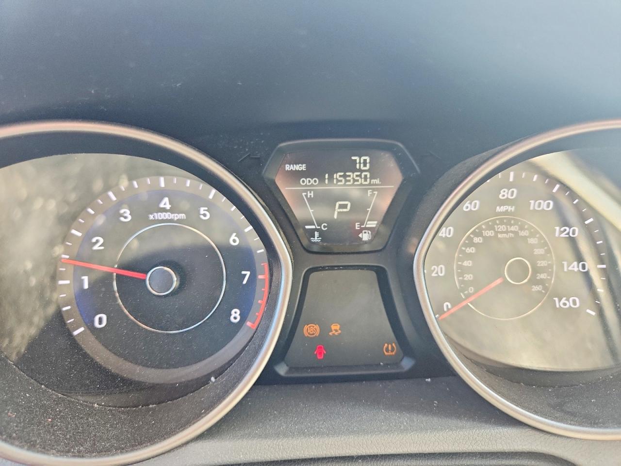 2011 Hyundai Elantra Gls Угольный vin: 5NPDH4AE0BH046879