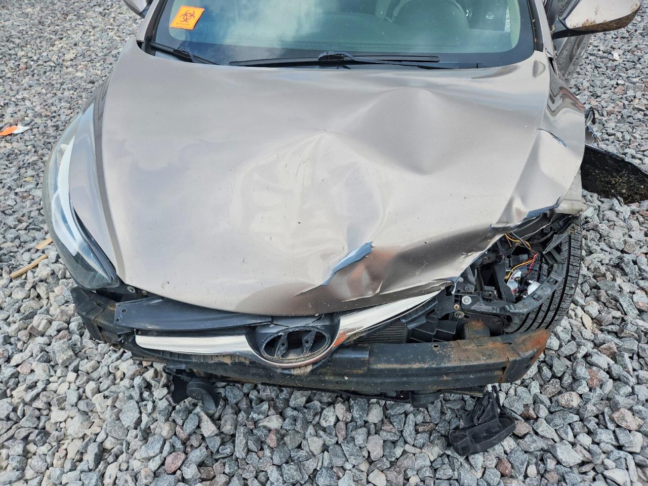 2014 Hyundai Elantra Se Charcoal vin: 5NPDH4AE2EH457298