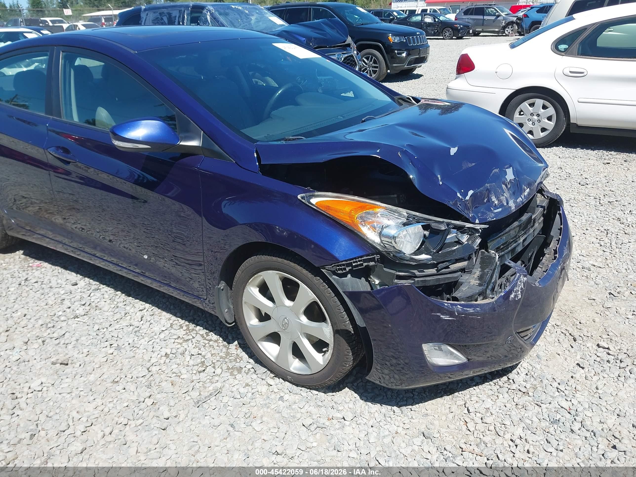 2012 Hyundai Elantra Limited Dark Blue vin: 5NPDH4AE6CH106116