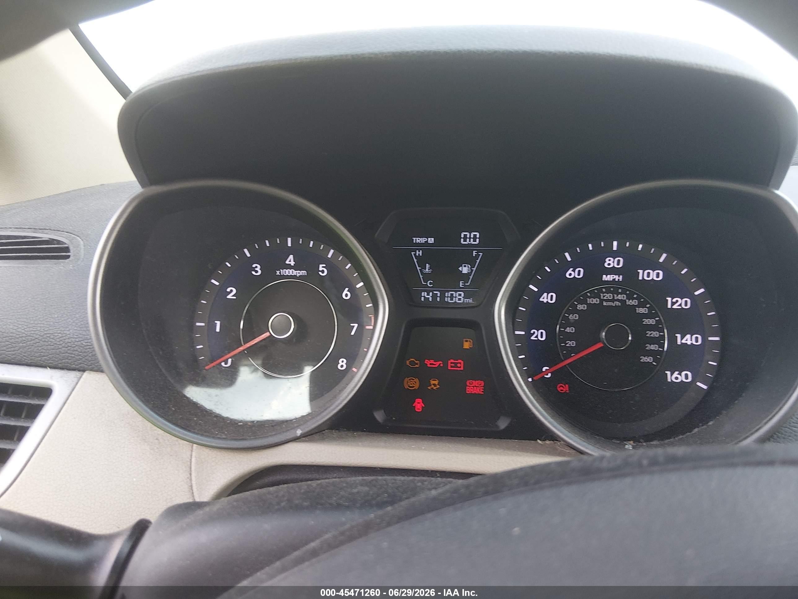 2014 Hyundai Elantra Se Brown vin: 5NPDH4AE7EH477658