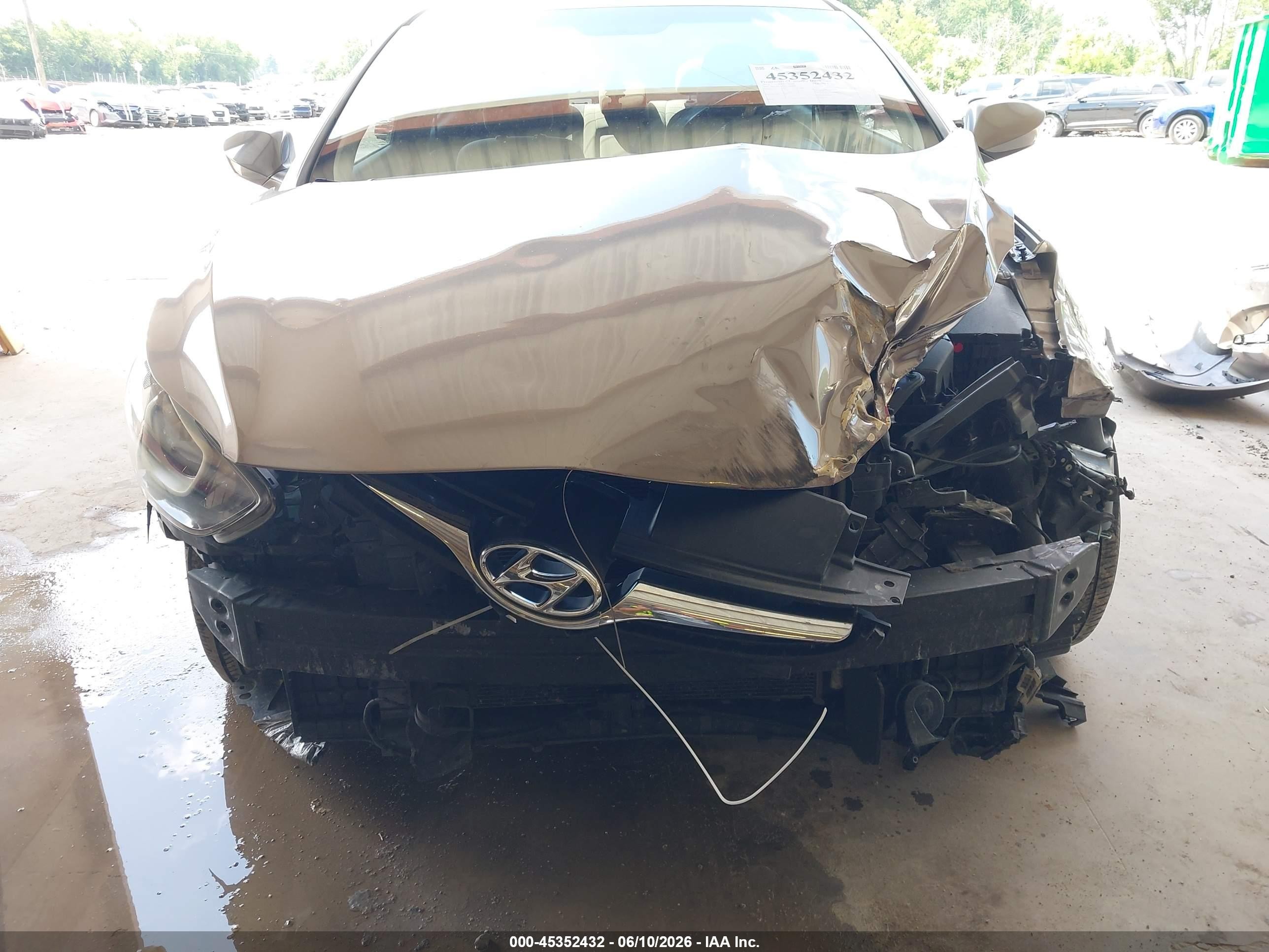 2014 Hyundai Elantra Se Gold vin: 5NPDH4AE7EH480608