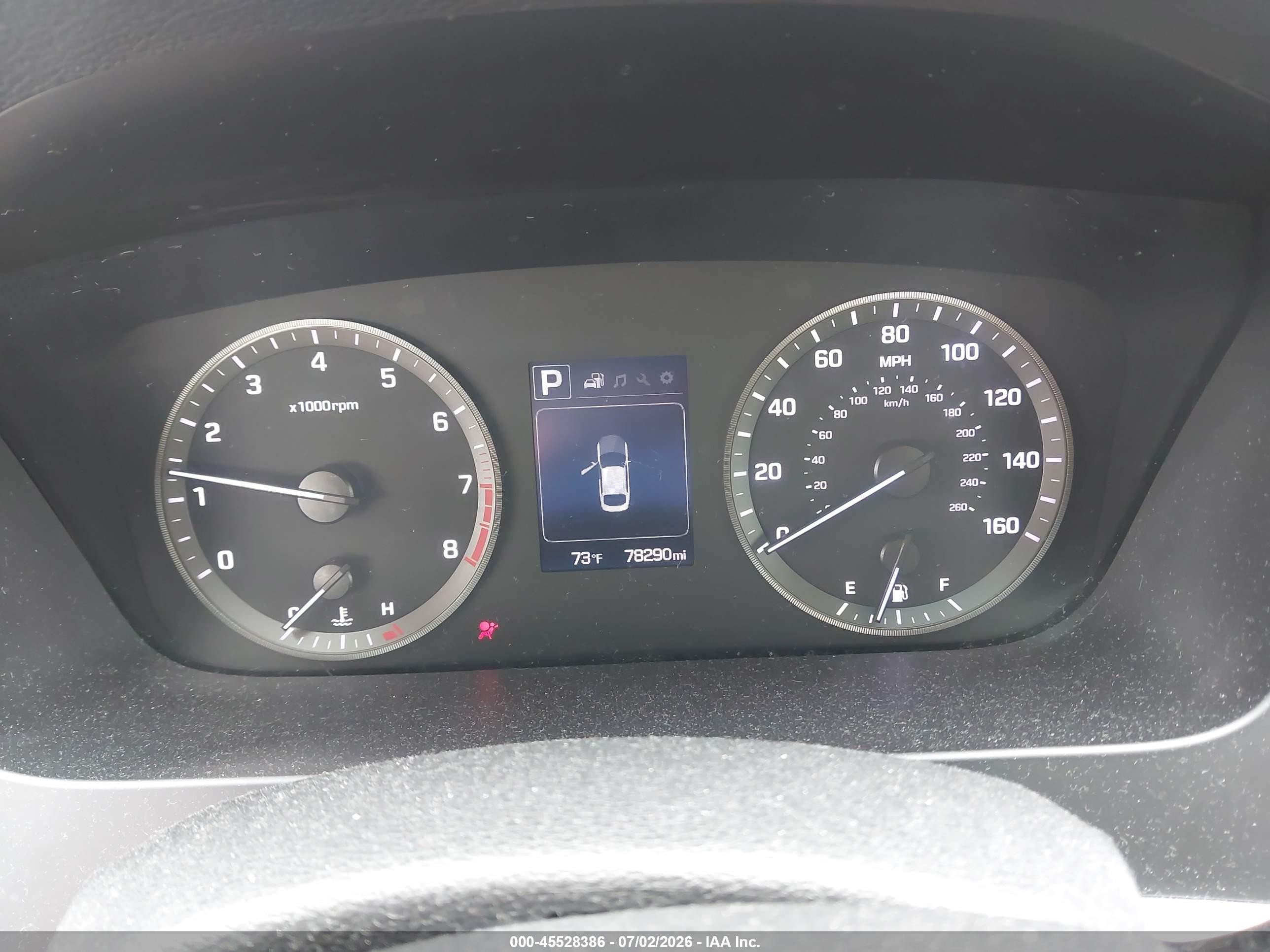 2015 Hyundai Sonata Se Black vin: 5NPE24AF6FH175133