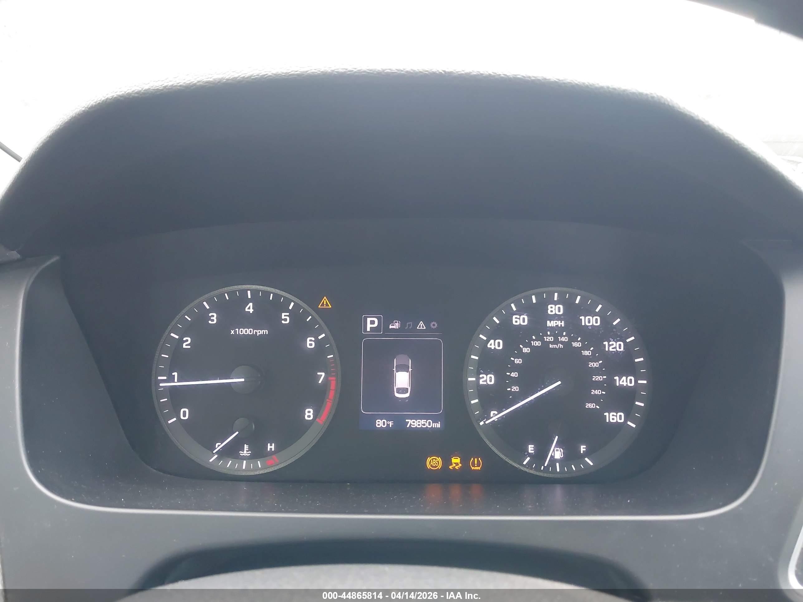2015 Hyundai Sonata Se Gray vin: 5NPE24AF7FH120707