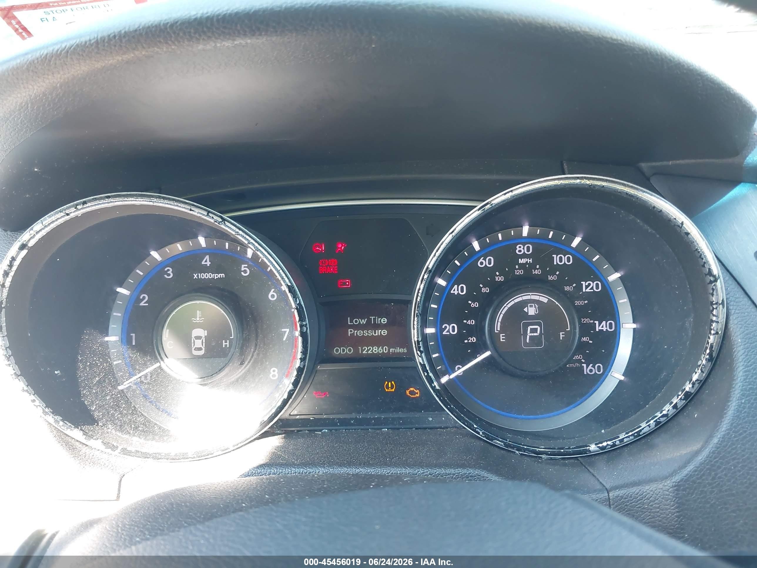 2014 Hyundai Sonata Gls Black vin: 5NPEB4AC9EH813945