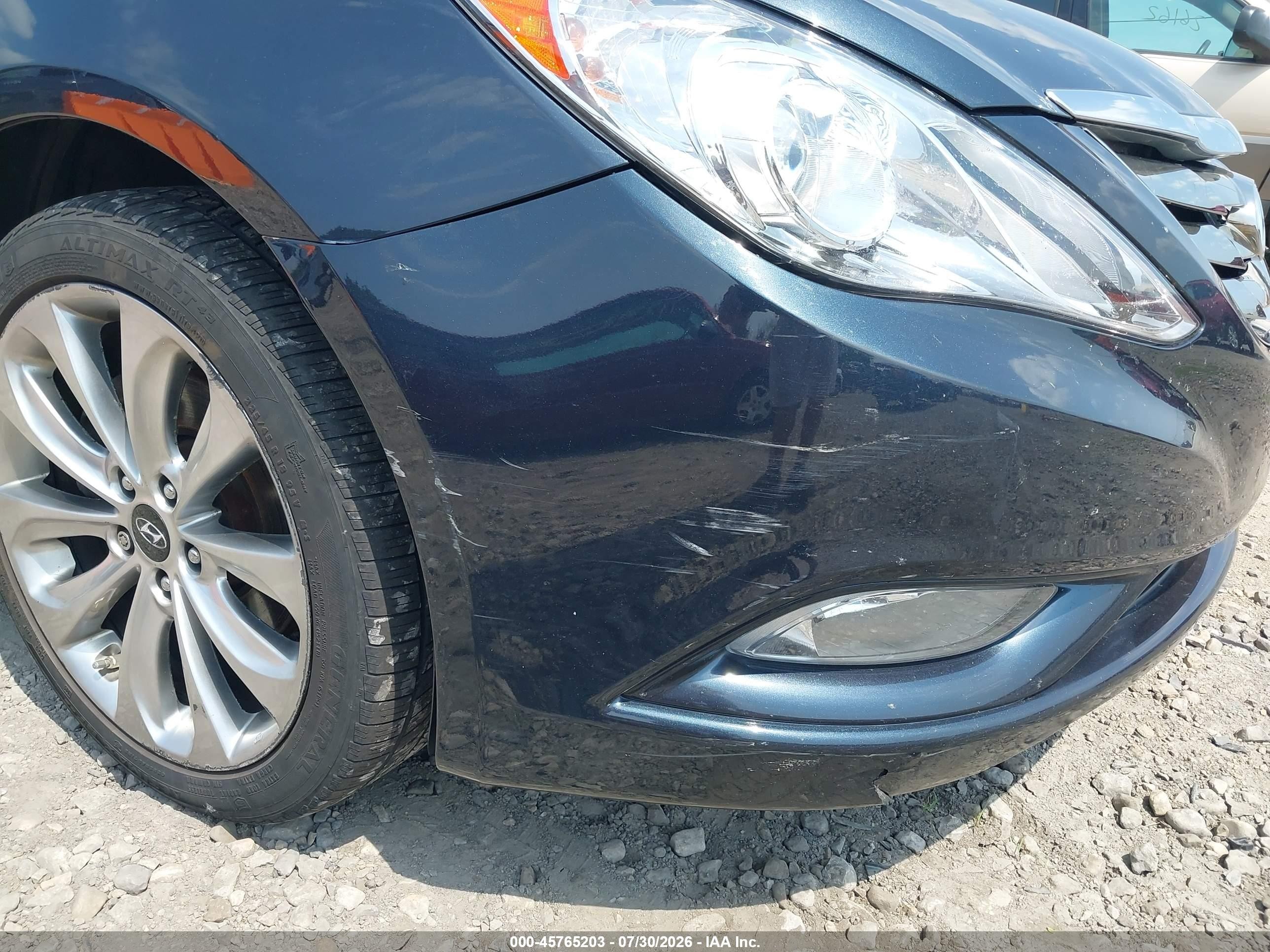 2011 Hyundai Sonata Se Black vin: 5NPEC4AC3BH292701