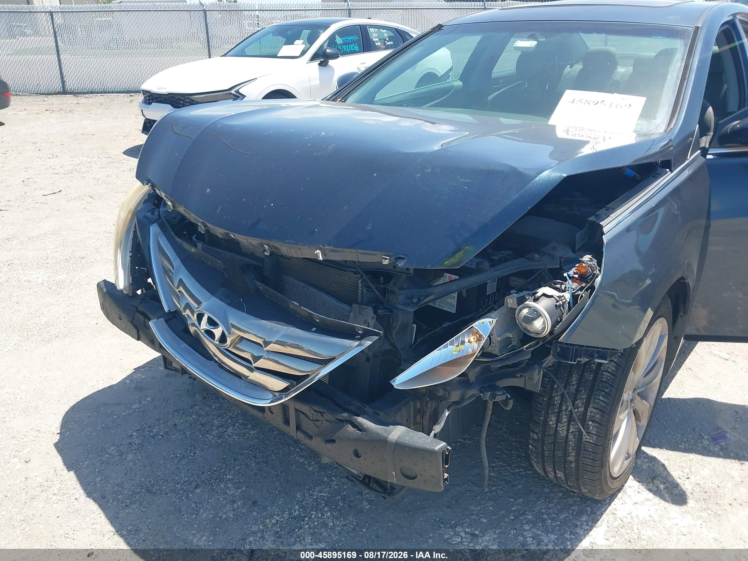 2011 Hyundai Sonata Se Gray vin: 5NPEC4AC5BH214615