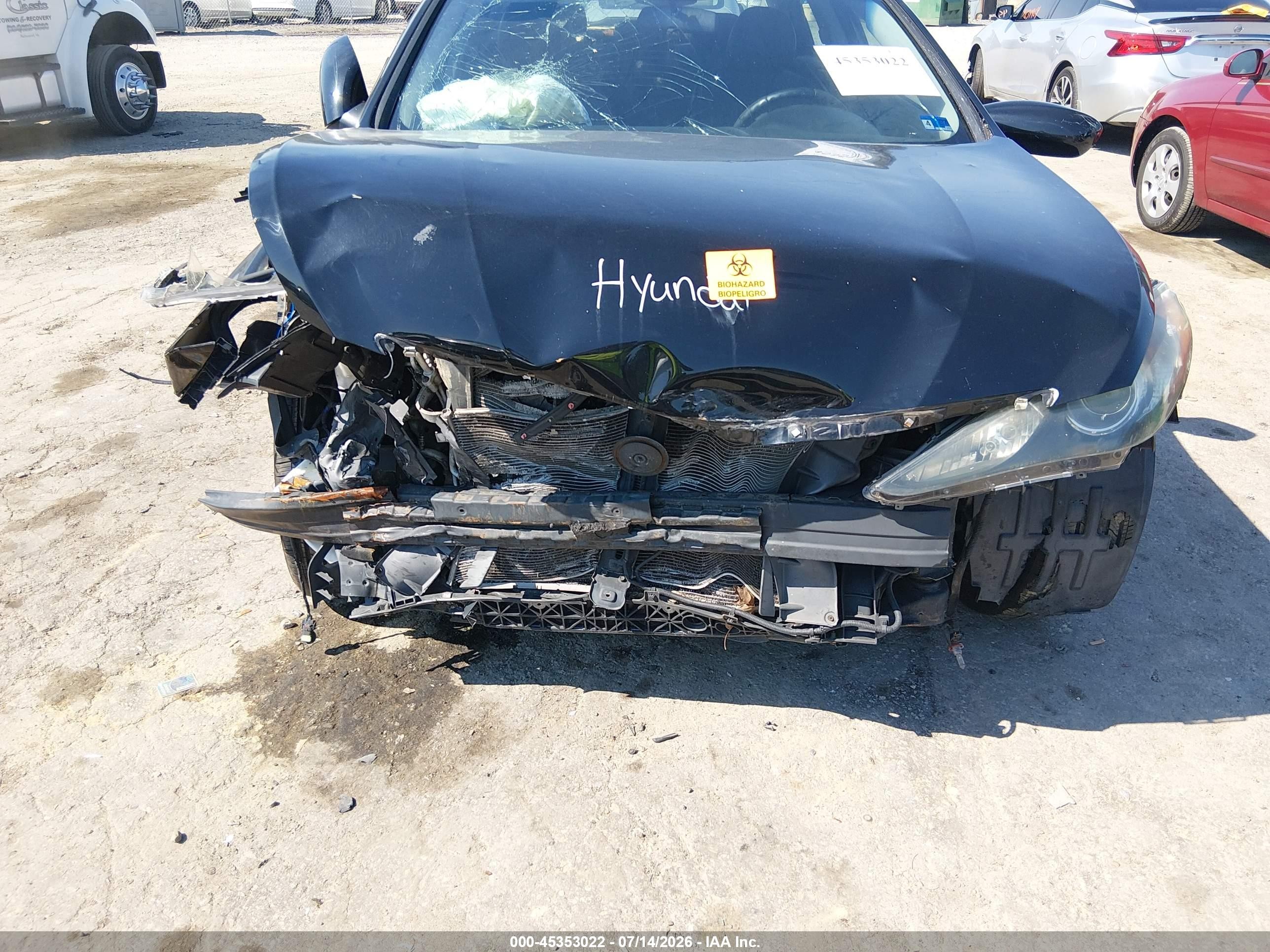 2011 Hyundai Sonata Se Black vin: 5NPEC4AC7BH003710