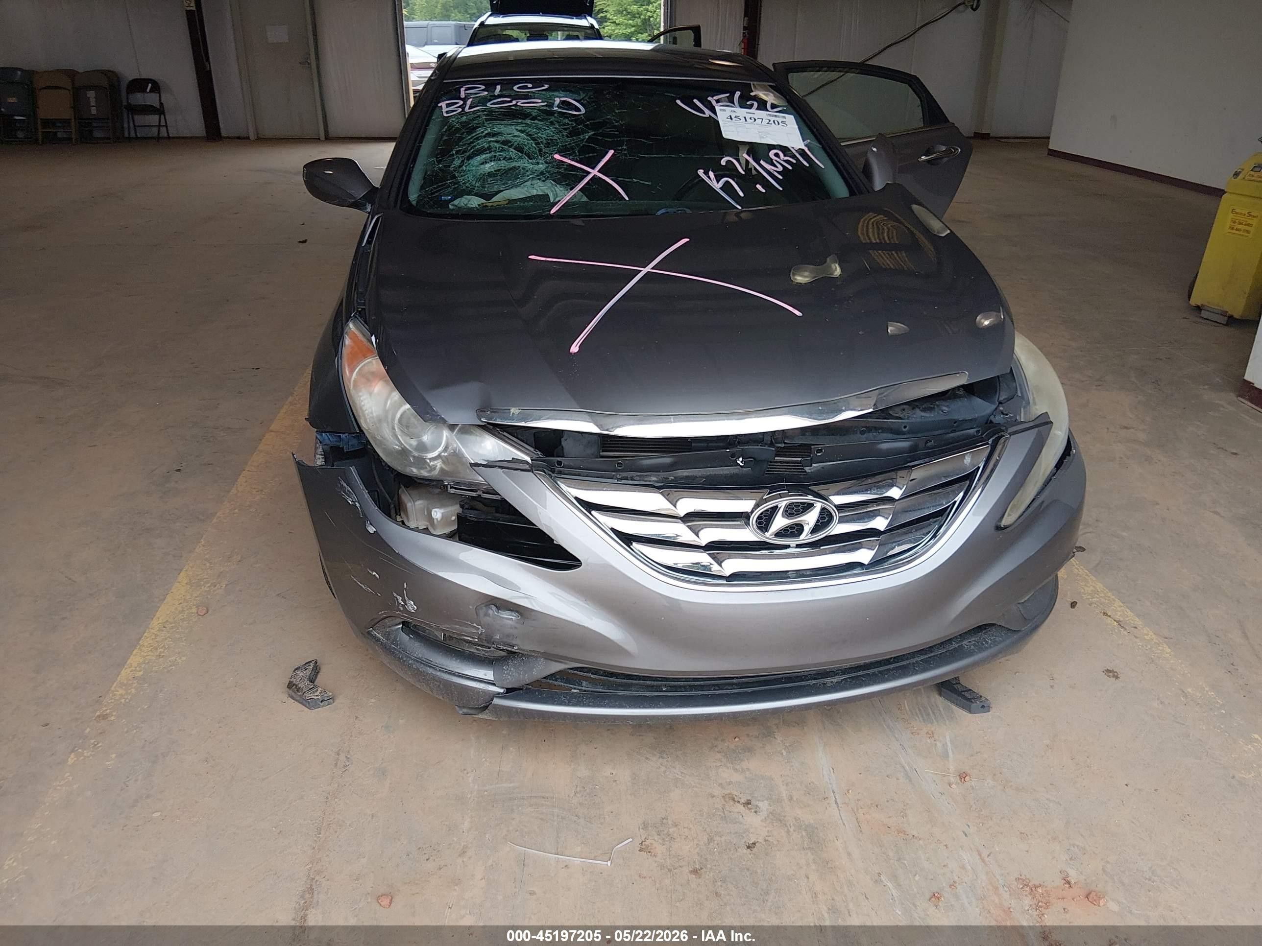 2011 Hyundai Sonata Se/limited Gray vin: 5NPEC4ACXBH214562