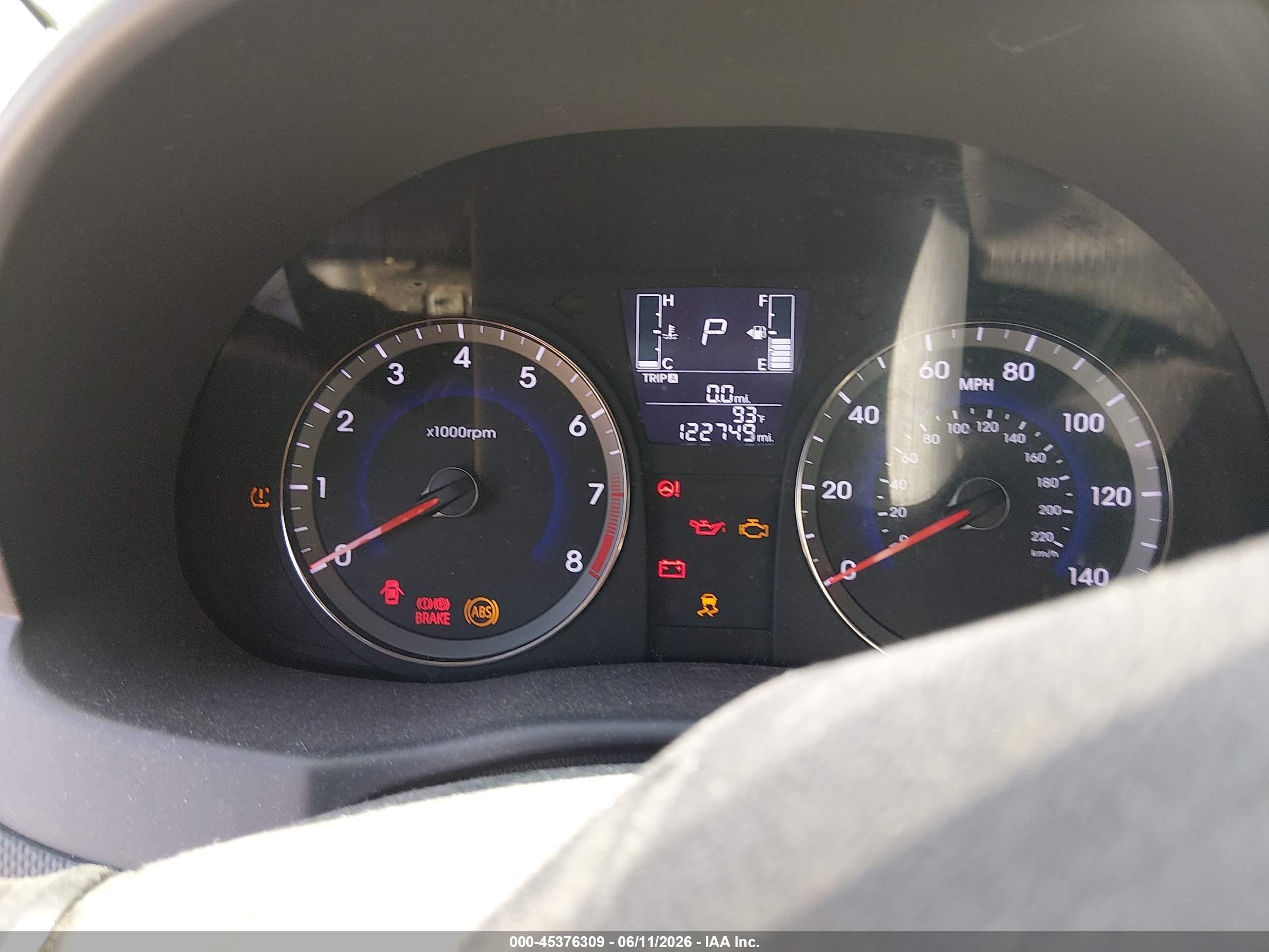 2017 Hyundai Accent Se Белый vin: KMHCT4AE0HU193384