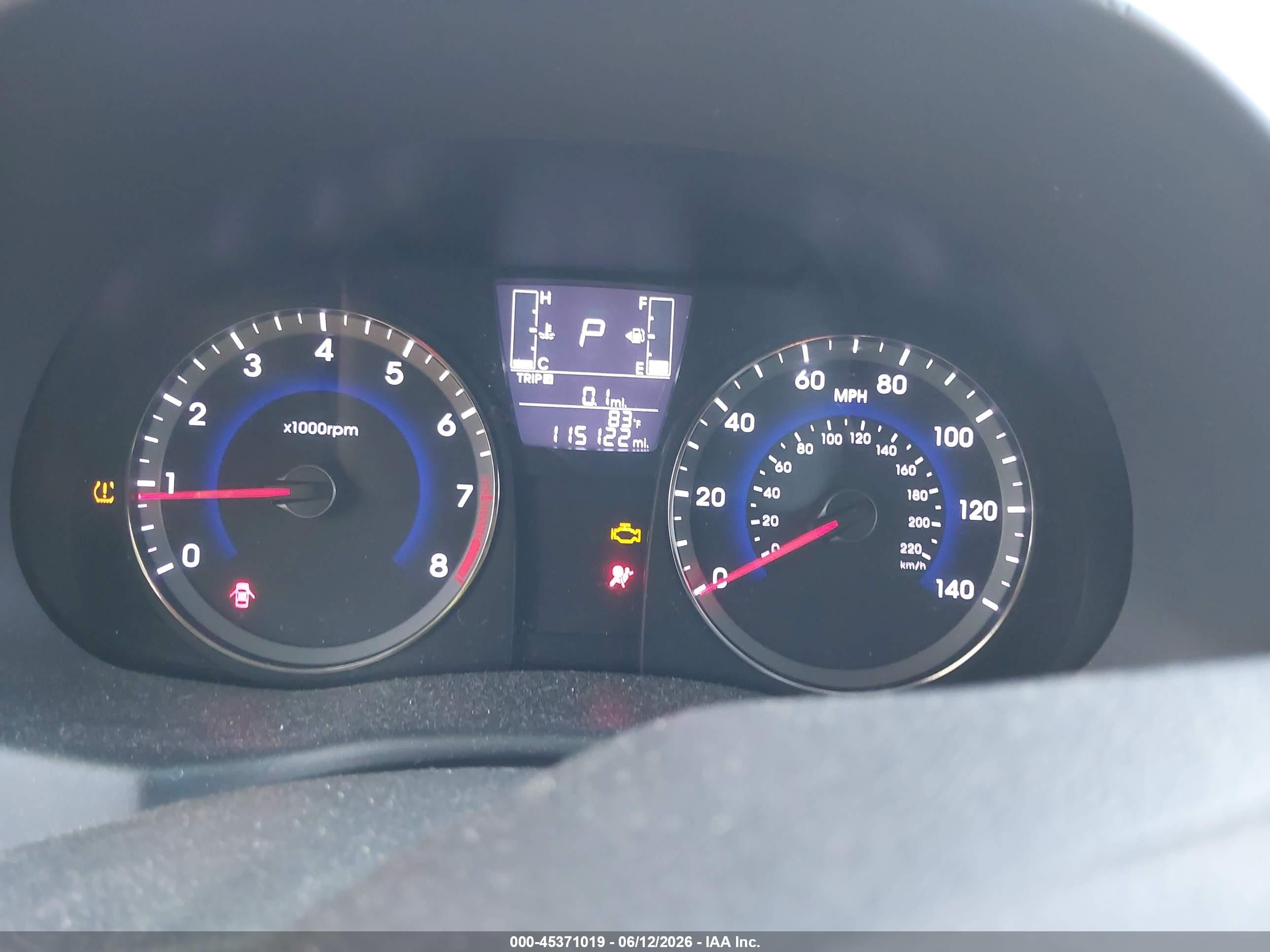 2017 Hyundai Accent Se Черный vin: KMHCT4AEXHU375397