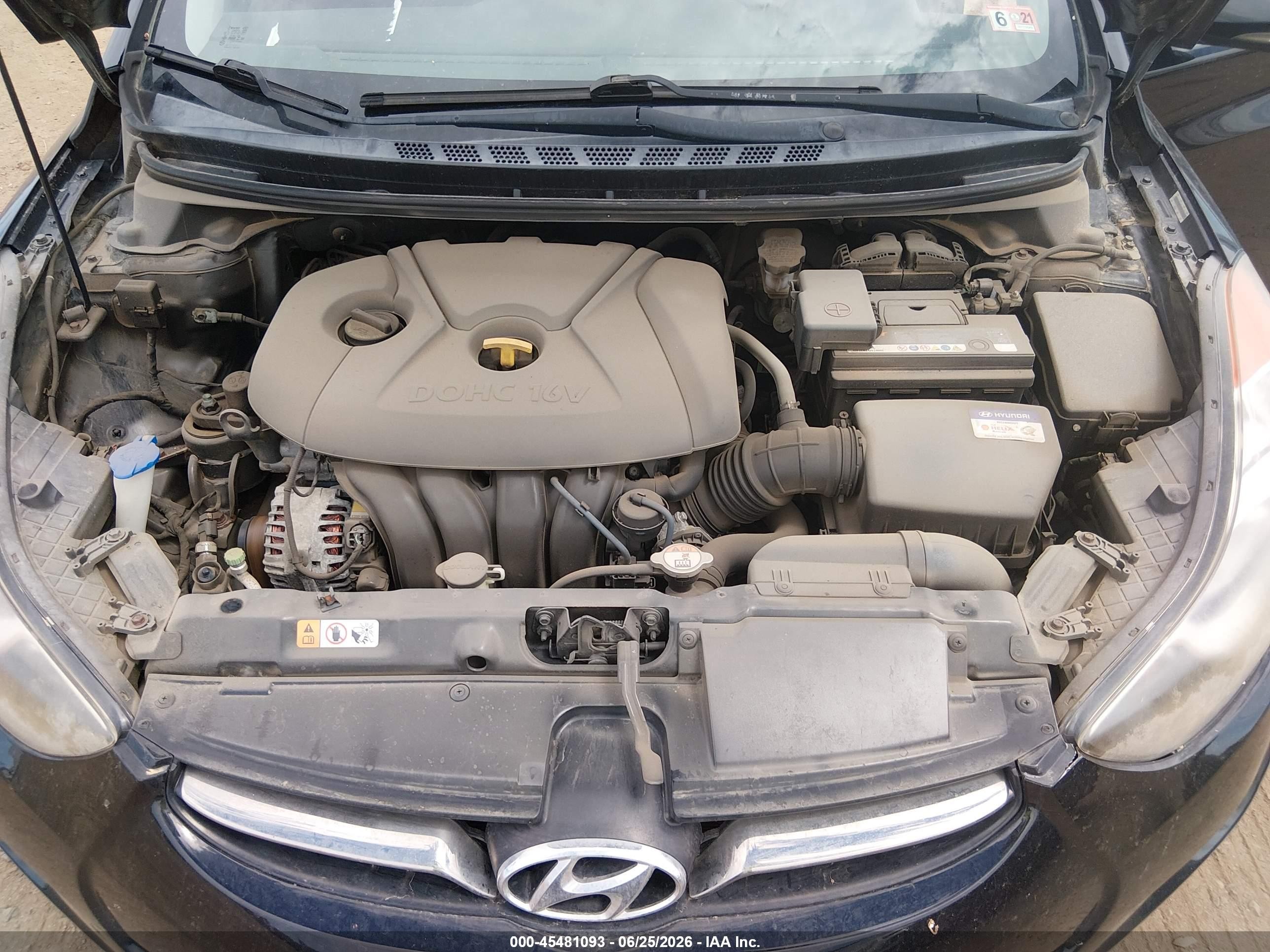 2012 Hyundai Elantra Limited (ulsan Plant) Черный vin: KMHDH4AE0CU463325