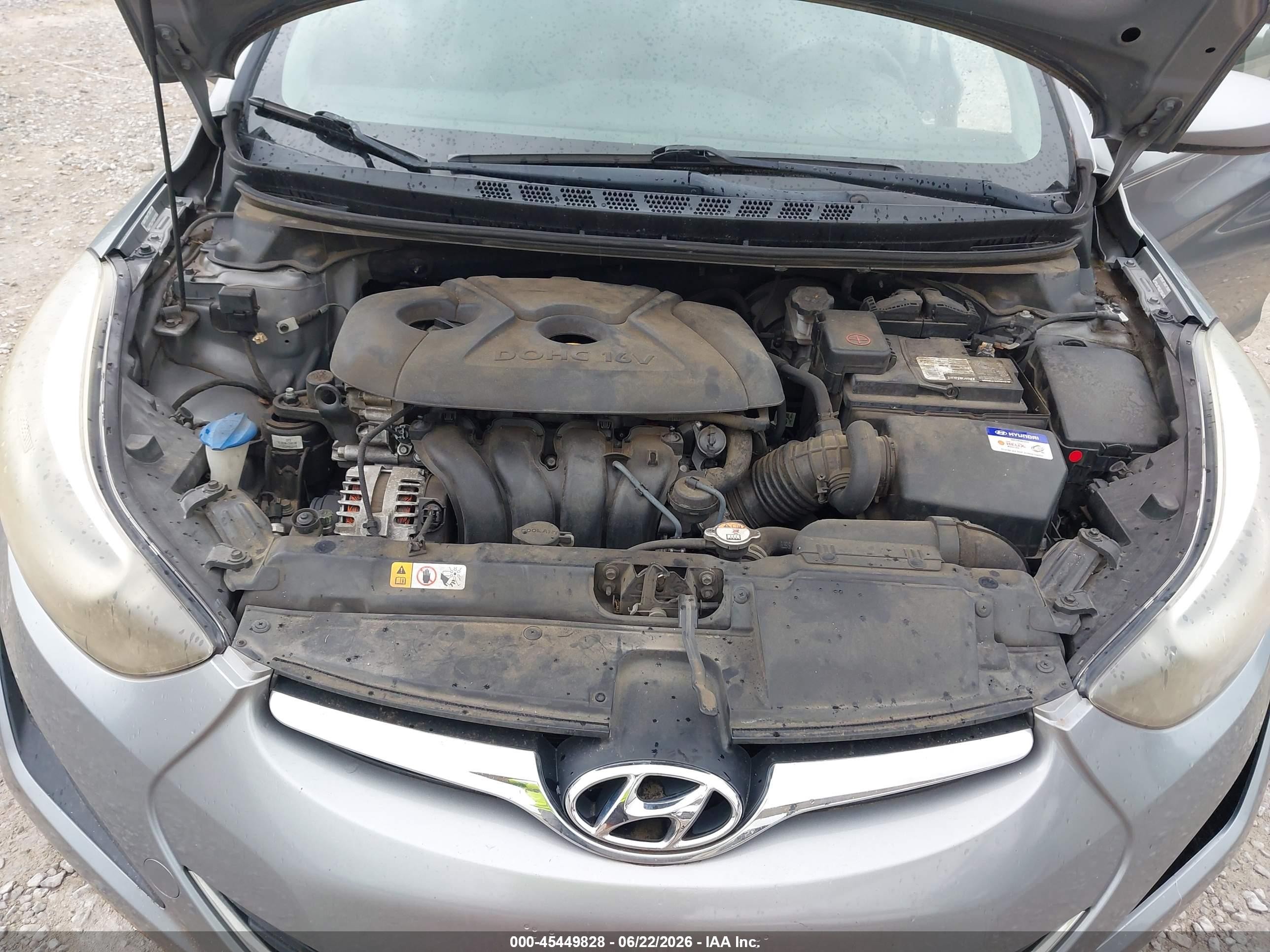 2015 Hyundai Elantra Se Gray vin: KMHDH4AE0FU359146