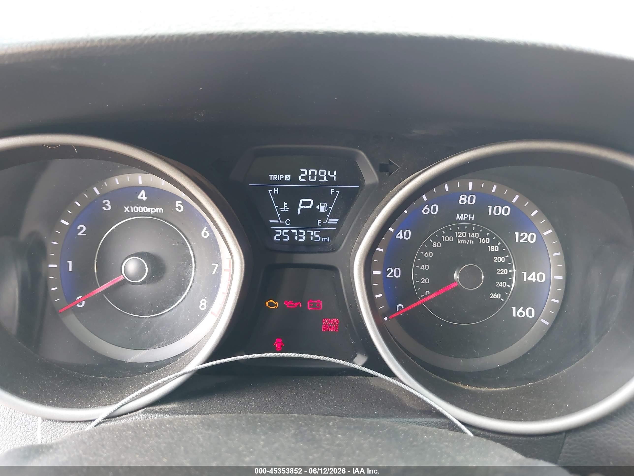 2014 Hyundai Elantra Limited Gray vin: KMHDH4AE3EU155312