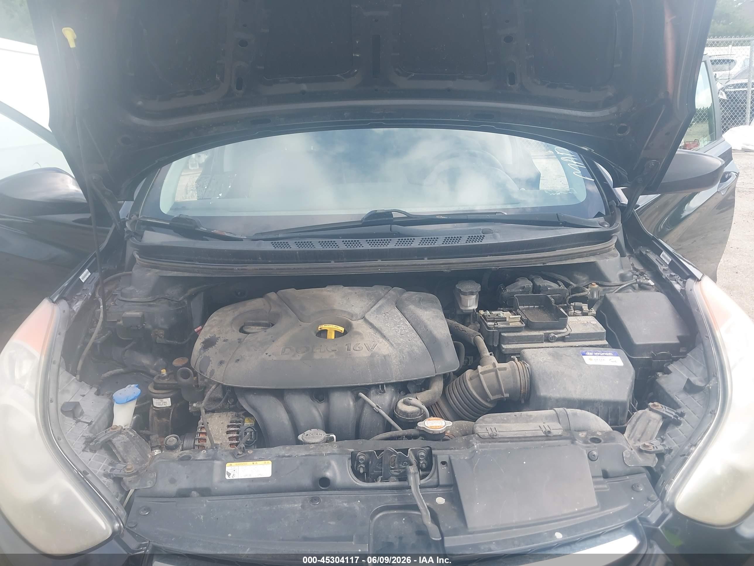 2011 Hyundai Elantra Gls (ulsan Plant) Black vin: KMHDH4AE4BU106020