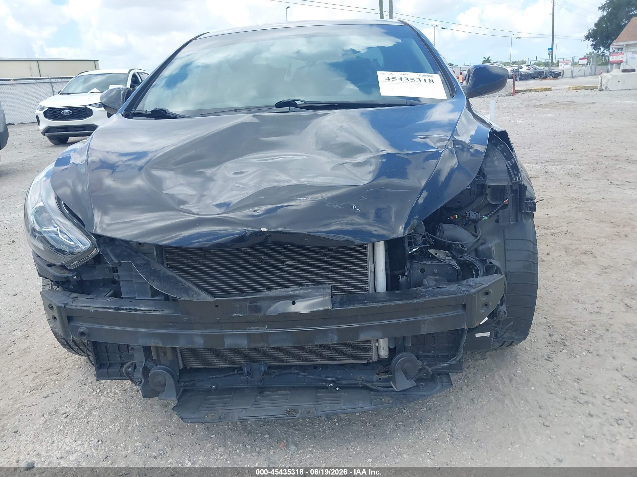 2015 Hyundai Elantra Se Black vin: KMHDH4AE4FU261429