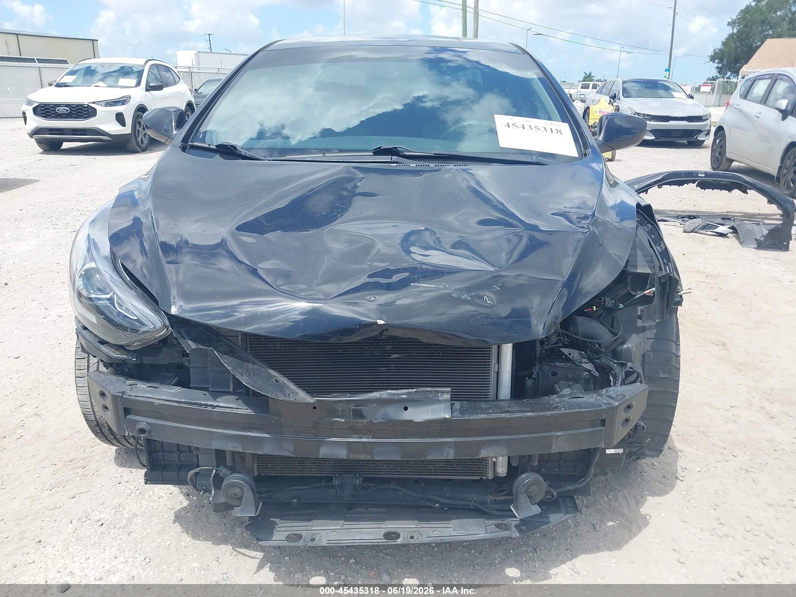 2015 Hyundai Elantra Se Black vin: KMHDH4AE4FU261429