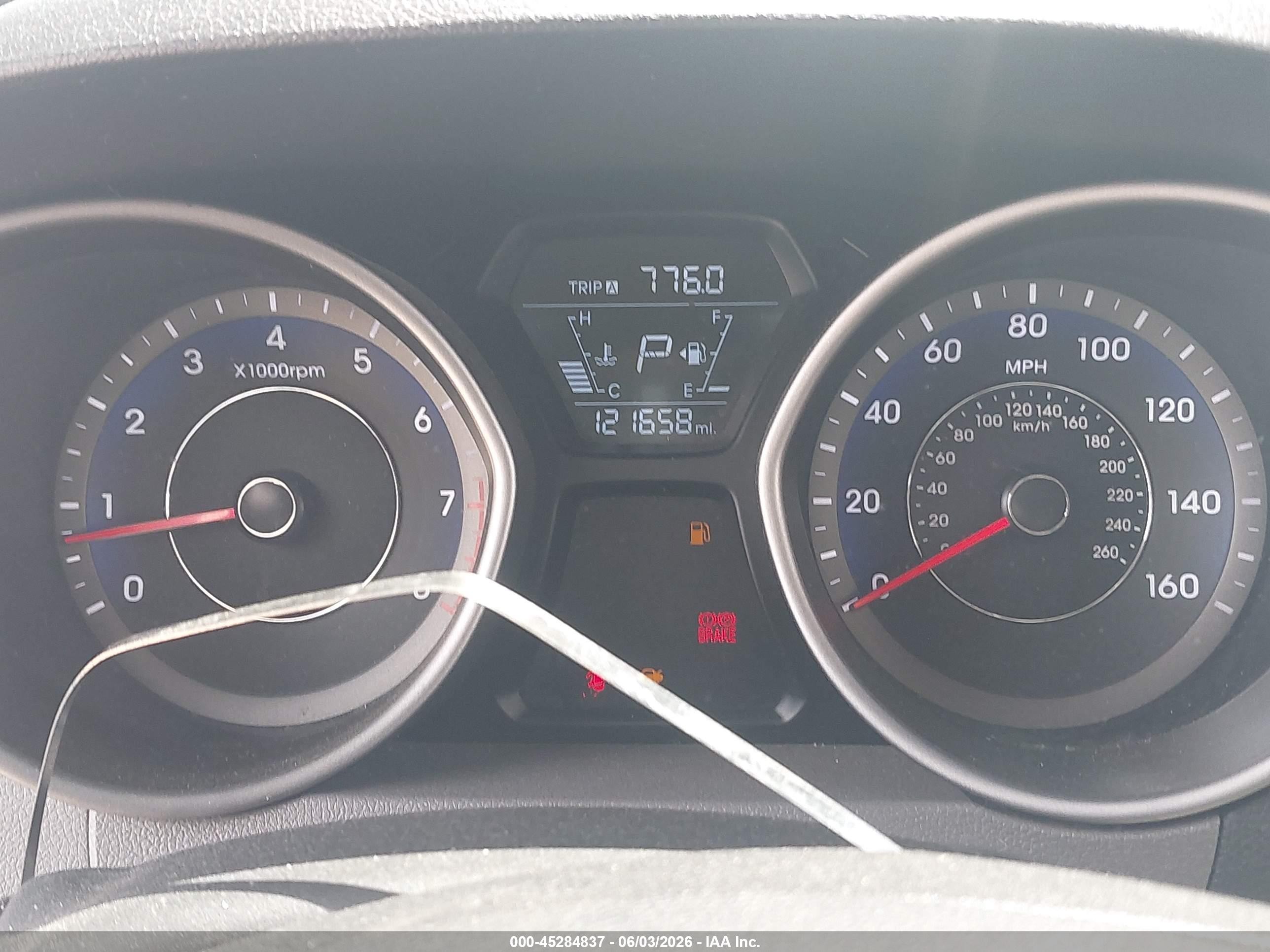 2015 Hyundai Elantra Se Black vin: KMHDH4AE4FU263326