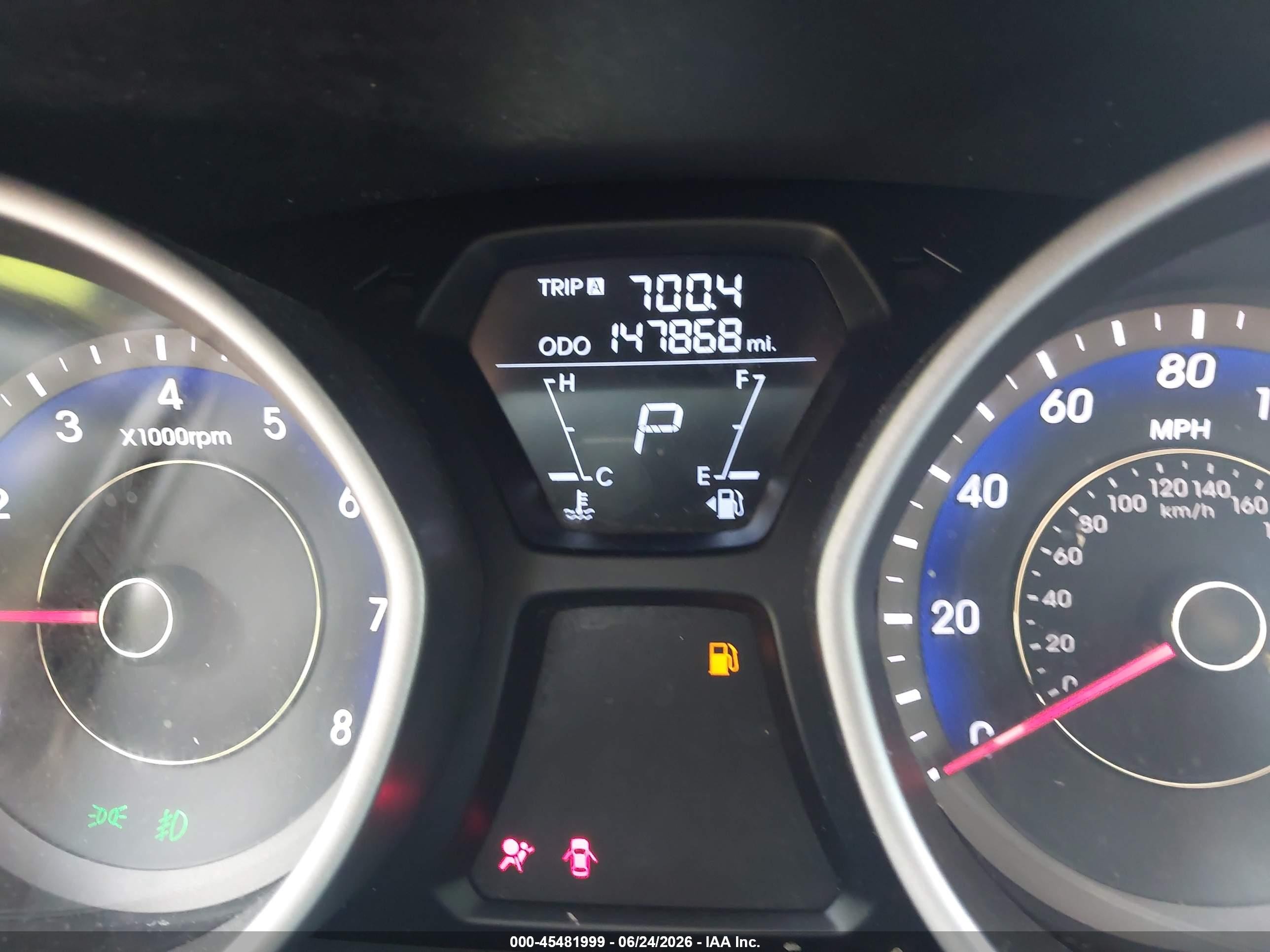 2013 Hyundai Elantra Gls Черный vin: KMHDH4AE6DU503540