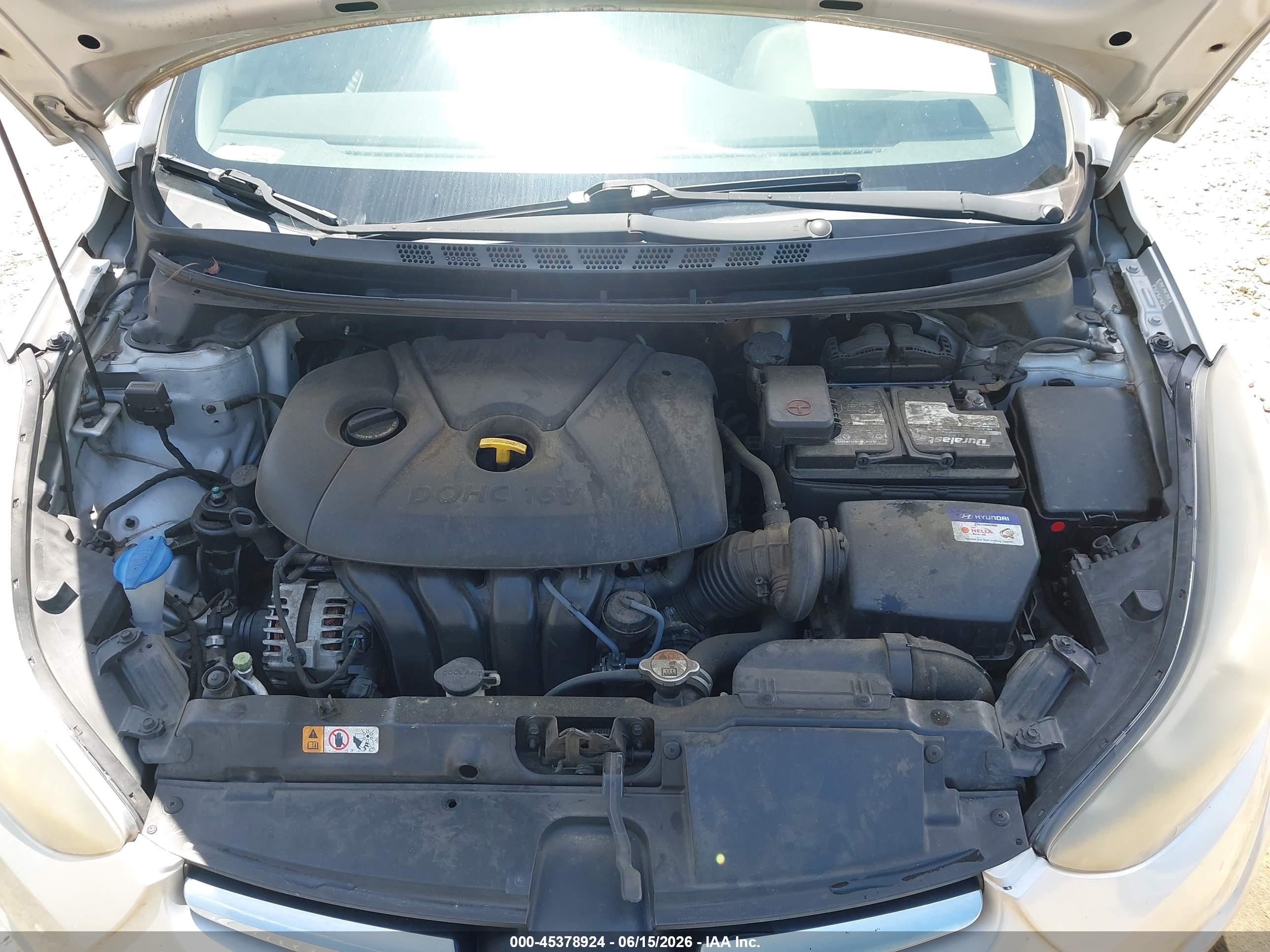 2015 Hyundai Elantra Se Gray vin: KMHDH4AE6FU298675
