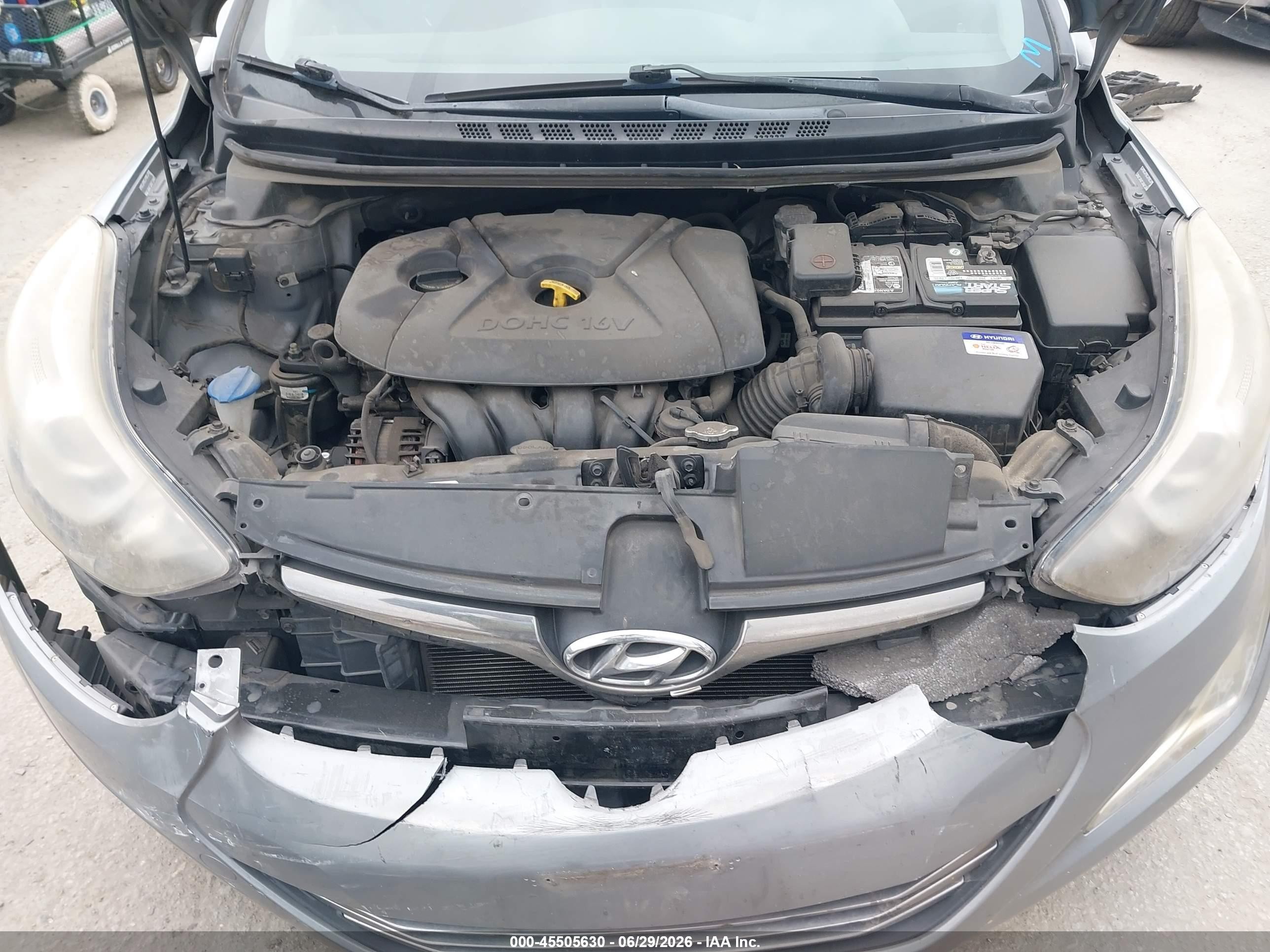 2015 Hyundai Elantra Limited Gray vin: KMHDH4AE6FU301249