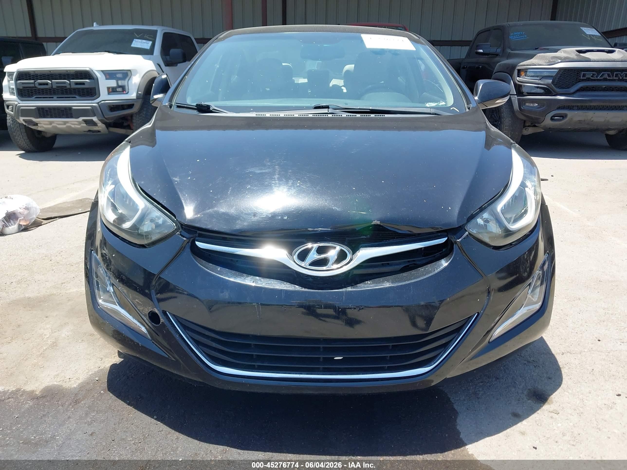 2015 Hyundai Elantra Limited Black vin: KMHDH4AE7FU437759
