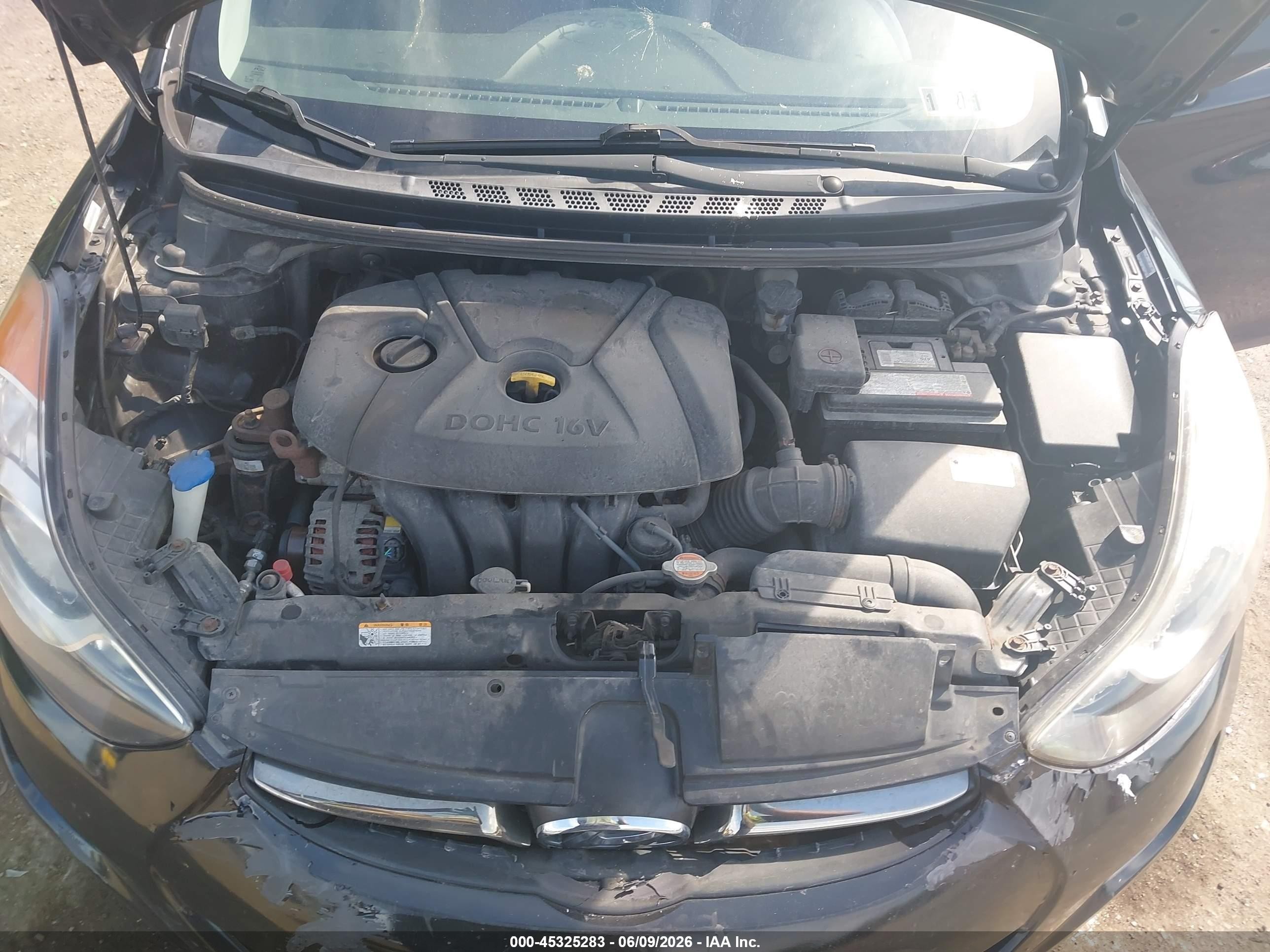 2012 Hyundai Elantra Limited (ulsan Plant) Black vin: KMHDH4AEXCU213638