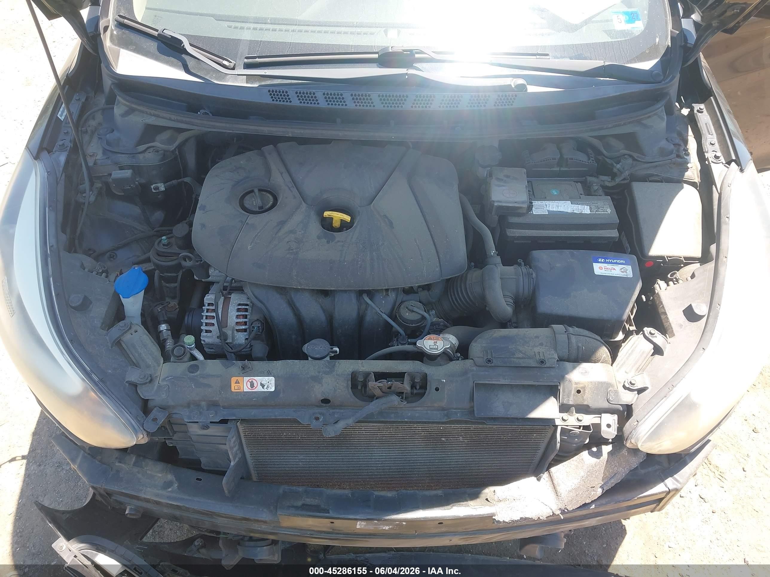 2014 Hyundai Elantra Se Black vin: KMHDH4AEXEU088840