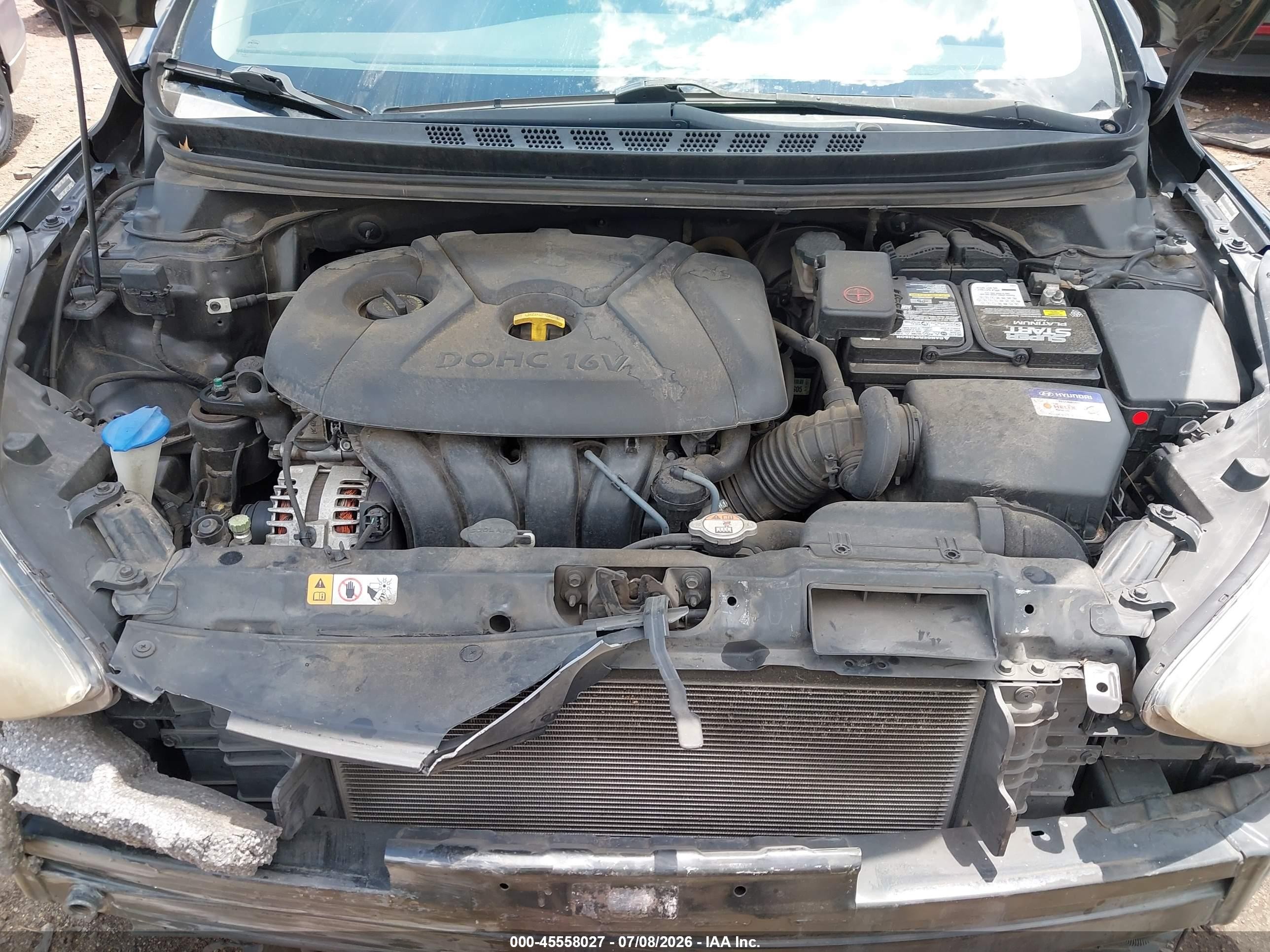 2014 Hyundai Elantra Se Black vin: KMHDH4AEXEU090328