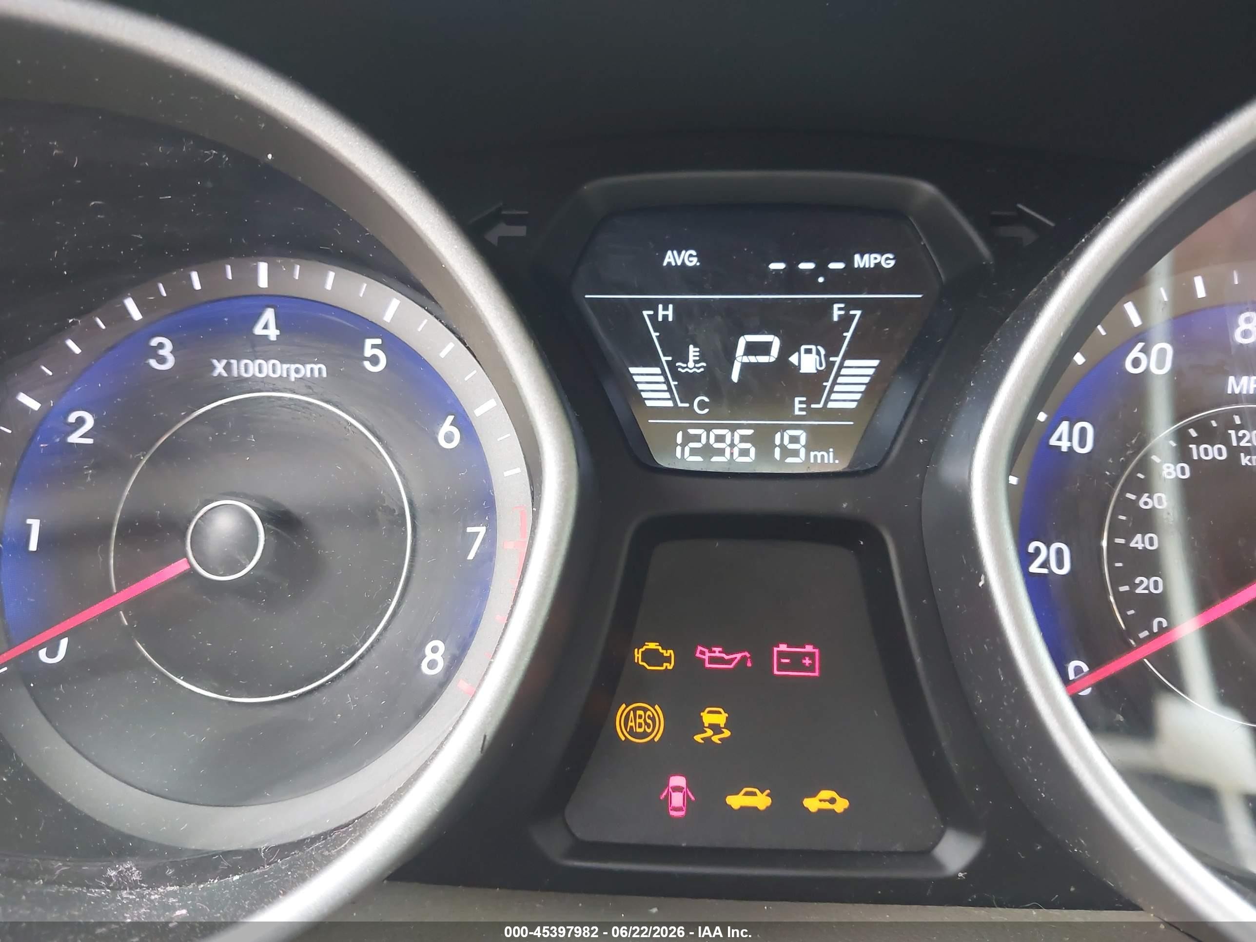 2015 Hyundai Elantra Sport Black vin: KMHDH4AHXFU371444