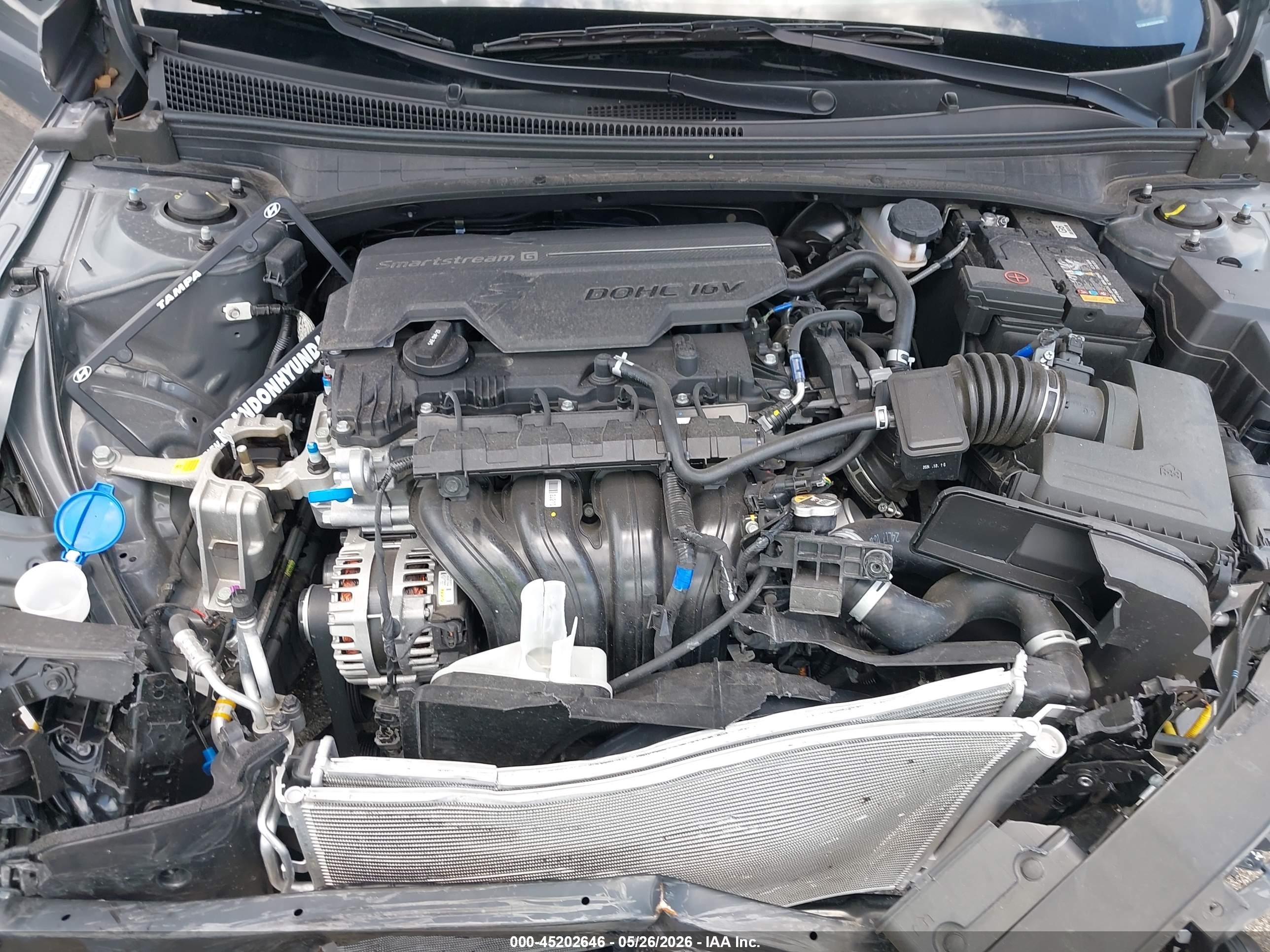 2025 Hyundai Elantra Sel Sport Gray vin: KMHLM4DG3SU957486