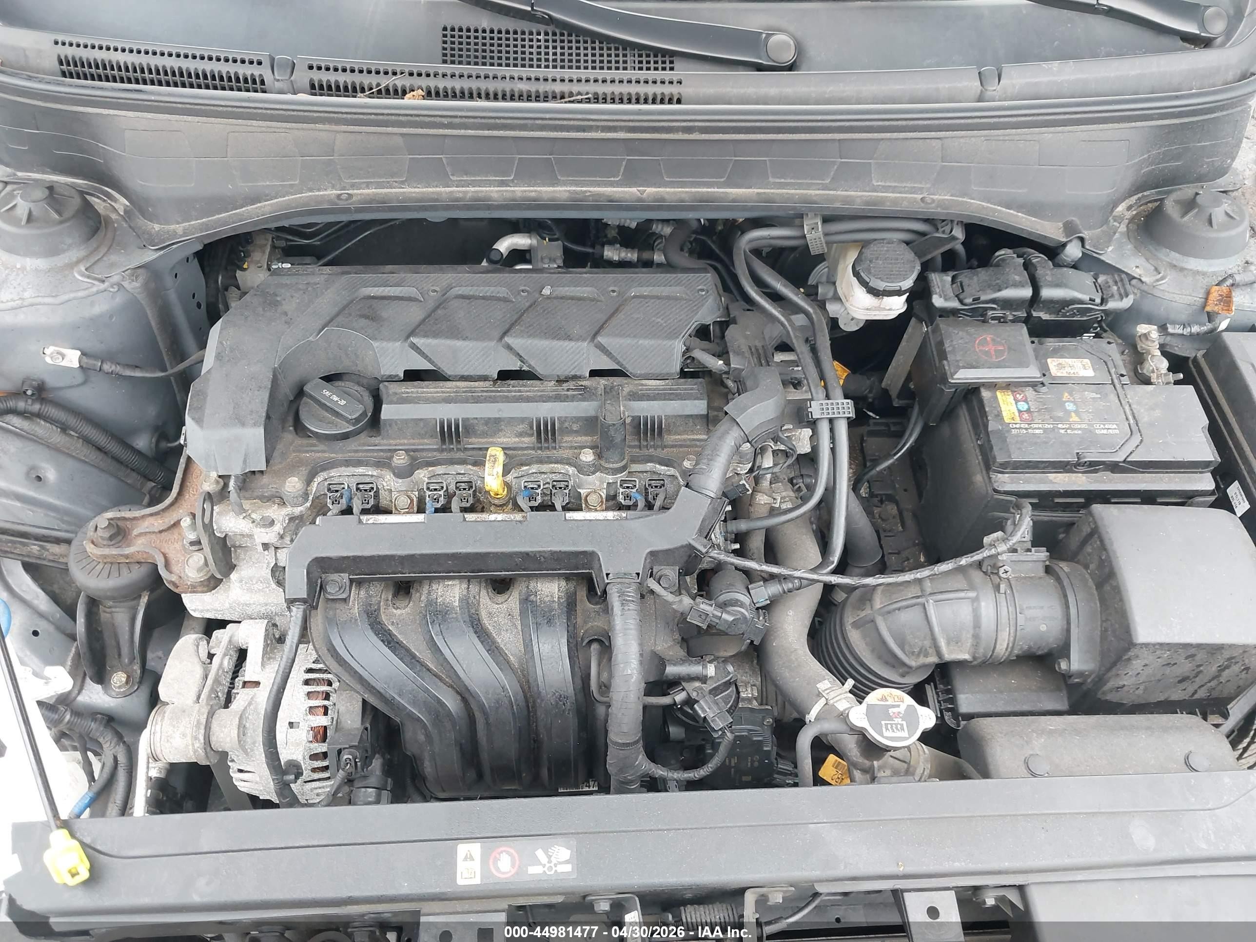 2022 Hyundai Venue Sel Gray vin: KMHRC8A35NU181713